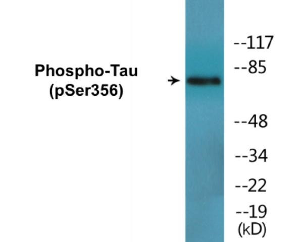 Tau (Phospho-Ser356)Colorimetric Cell-Based ELISA Kit (CBCAB00489)
