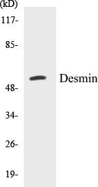 Desmin Colorimetric Cell-Based ELISA Kit (CBCAB00624)