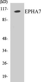 EPHA7 Colorimetric Cell-Based ELISA Kit (CBCAB00640)