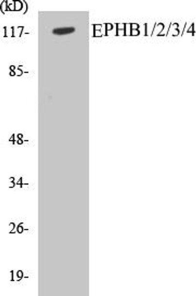EPHB1/2/3/4 Colorimetric Cell-Based ELISA Kit (CBCAB00642)