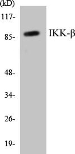 IKK-beta Colorimetric Cell-Based ELISA Kit (CBCAB00708)