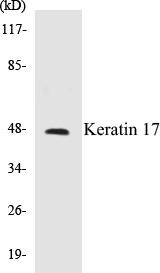 Keratin 17 Colorimetric Cell-Based ELISA Kit (CBCAB00725)