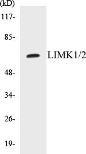 LIMK1/2 Colorimetric Cell-Based ELISA Kit (CBCAB00737)