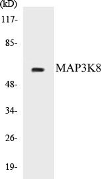 MAP3K8 Colorimetric Cell-Based ELISA Kit (CBCAB00742)