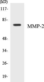 MMP-2 Colorimetric Cell-Based ELISA Kit (CBCAB00764)