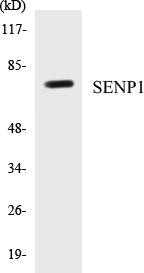 SENP1 Colorimetric Cell-Based ELISA Kit (CBCAB00850)