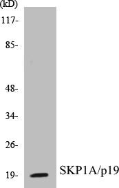 SKP1A/p19 Colorimetric Cell-Based ELISA Kit (CBCAB00856)