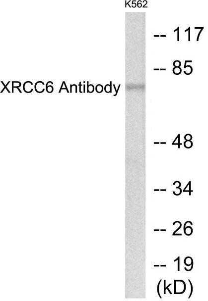XRCC6 Colorimetric Cell-Based ELISA (CBCAB00917)