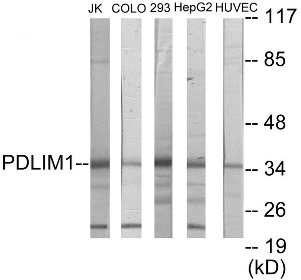 PDLIM1 Colorimetric Cell-Based ELISA (CBCAB00919)