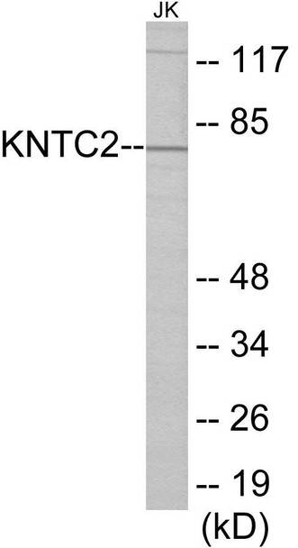 KNTC2 Colorimetric Cell-Based ELISA (CBCAB00926)