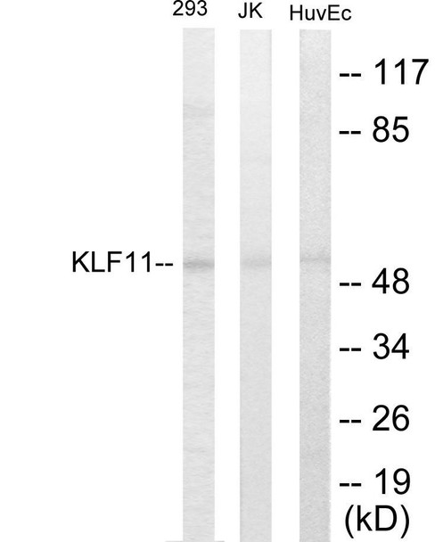KLF11 Colorimetric Cell-Based ELISA (CBCAB00927)