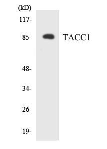 TACC1 Colorimetric Cell-Based ELISA (CBCAB00950)