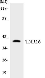 TNR16 Colorimetric Cell-Based ELISA (CBCAB00972)