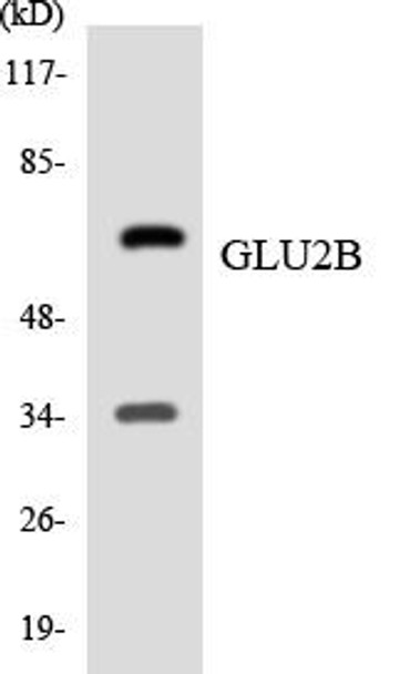 GLU2B Colorimetric Cell-Based ELISA (CBCAB00975)