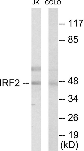 IRF2 Colorimetric Cell-Based ELISA (CBCAB00976)
