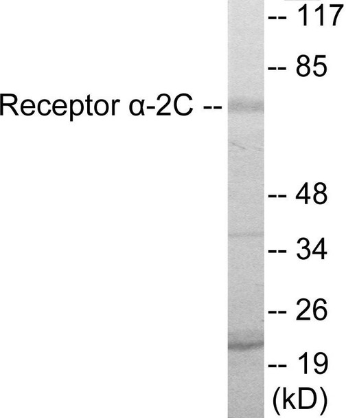 Adrenergic Receptor alpha-2C Colorimetric Cell-Based ELISA (CBCAB00983)