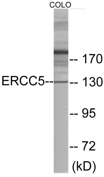 ERCC5 Colorimetric Cell-Based ELISA (CBCAB00996)