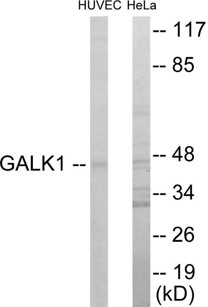 GALK1 Colorimetric Cell-Based ELISA (CBCAB01026)