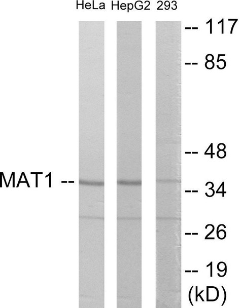 MAT1 Colorimetric Cell-Based ELISA (CBCAB01028)