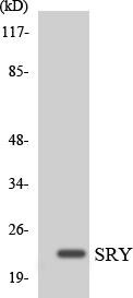 SRY Colorimetric Cell-Based ELISA (CBCAB01067)