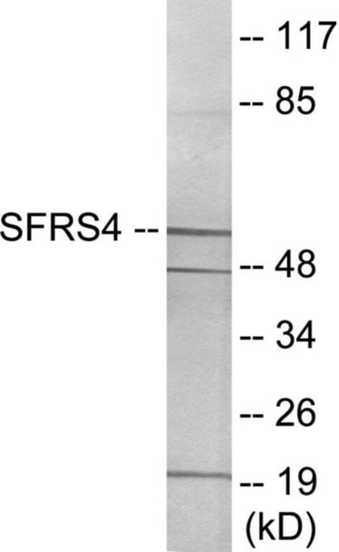 SFRS4 Colorimetric Cell-Based ELISA (CBCAB01069)