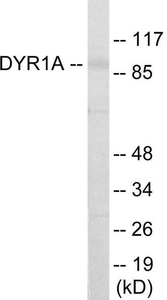 DYR1A Colorimetric Cell-Based ELISA (CBCAB01092)