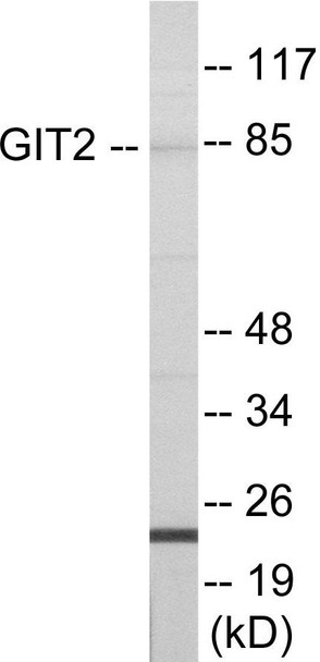 GIT2 Colorimetric Cell-Based ELISA (CBCAB01094)