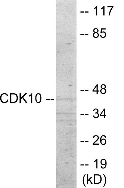 CDK10 Colorimetric Cell-Based ELISA (CBCAB01105)