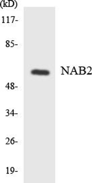 NAB2 Colorimetric Cell-Based ELISA (CBCAB01116)