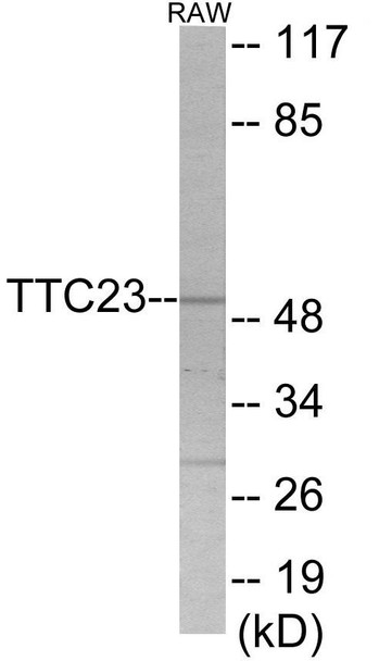 TTC23 Colorimetric Cell-Based ELISA (CBCAB01135)