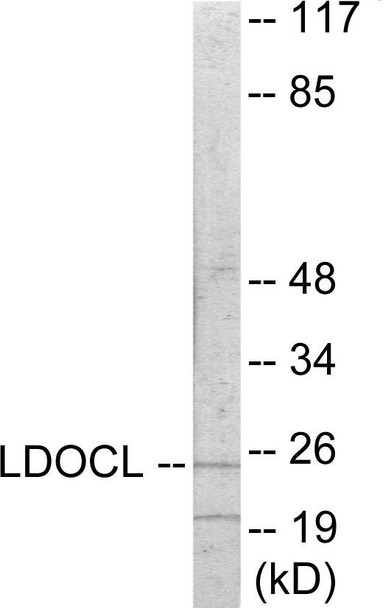 LDOC1L Colorimetric Cell-Based ELISA (CBCAB01137)