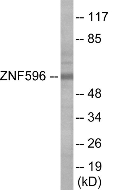 ZNF596 Colorimetric Cell-Based ELISA (CBCAB01161)