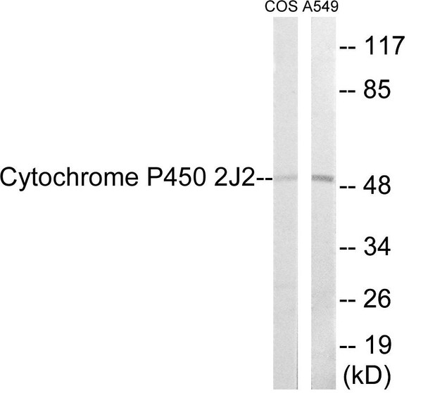 Cytochrome P450 2J2 Colorimetric Cell-Based ELISA (CBCAB01193)