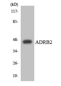 ADRB2 Colorimetric Cell-Based ELISA (CBCAB01203)