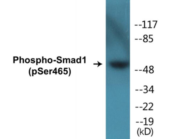 Smad1 (Phospho-Ser465)Colorimetric Cell-Based ELISA Kit (CBCAB01224)