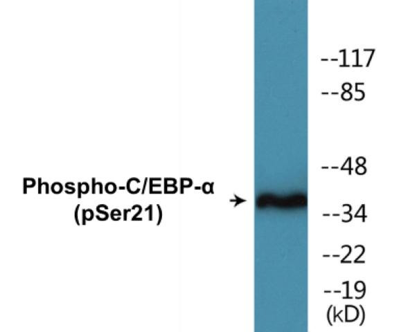 C/EBP-alpha (Phospho-Ser21)Colorimetric Cell-Based ELISA Kit (CBCAB01231)