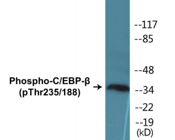 C/EBP-beta (Phospho-Thr235/188)Colorimetric Cell-Based ELISA Kit (CBCAB01232)