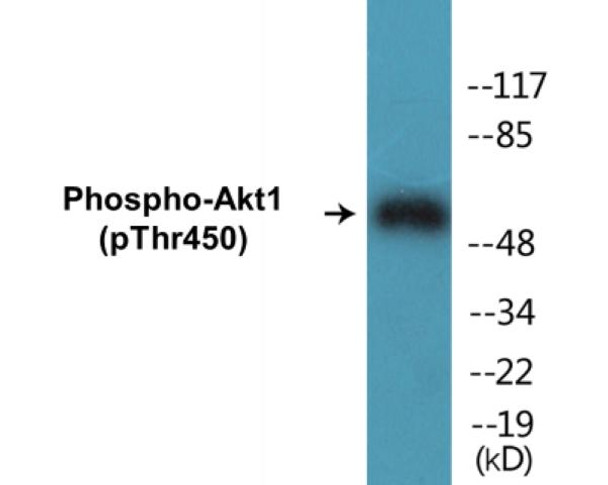 Akt1 (Phospho-Ser124)Colorimetric Cell-Based ELISA Kit (CBCAB01260)