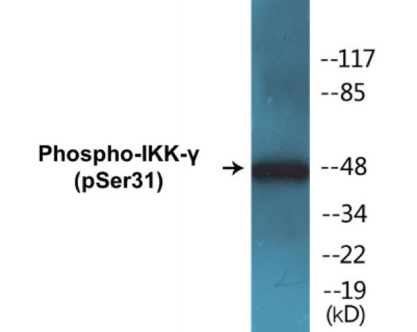 IKK-gamma (Phospho-Ser31)Colorimetric Cell-Based ELISA Kit (CBCAB01277)