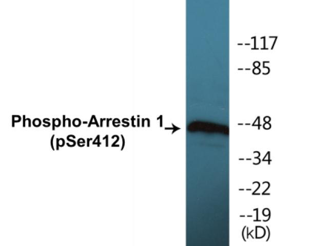 Arrestin 1 (Phospho-Ser412)Colorimetric Cell-Based ELISA Kit (CBCAB01283)