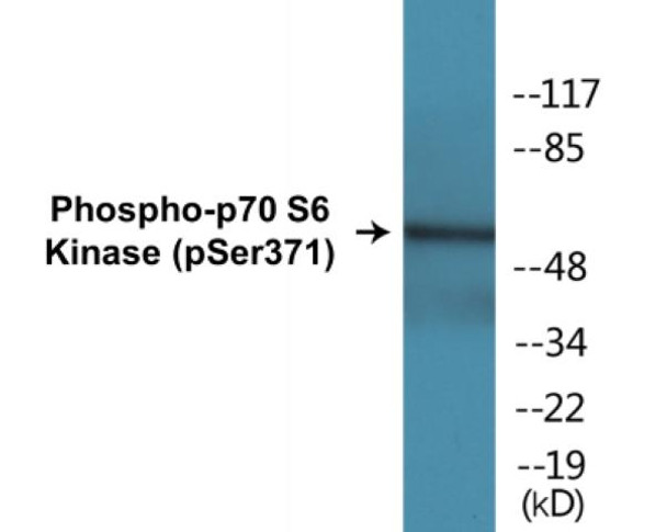 p70 S6 Kinase (Phospho-Ser371)Colorimetric Cell-Based ELISA Kit (CBCAB01307)