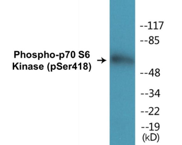 p70 S6 Kinase (Phospho-Ser418)Colorimetric Cell-Based ELISA Kit (CBCAB01308)