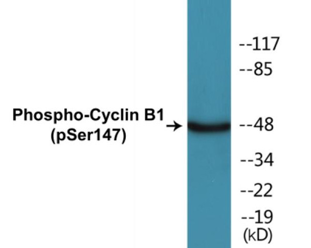 Cyclin B1 (Phospho-Ser147)Colorimetric Cell-Based ELISA Kit (CBCAB01339)