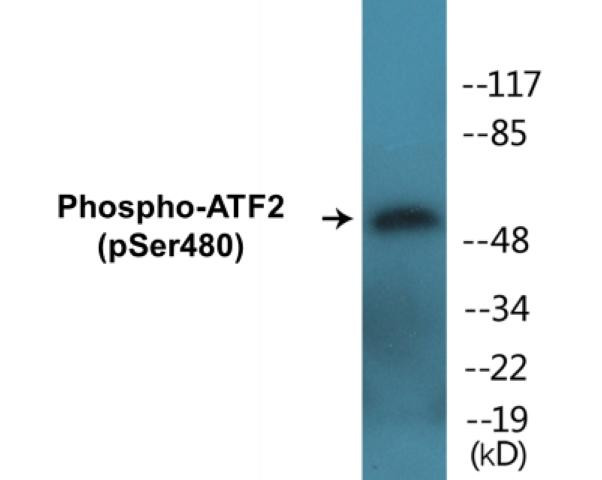 ATF2 (Phospho-Ser480)Colorimetric Cell-Based ELISA Kit (CBCAB01386)