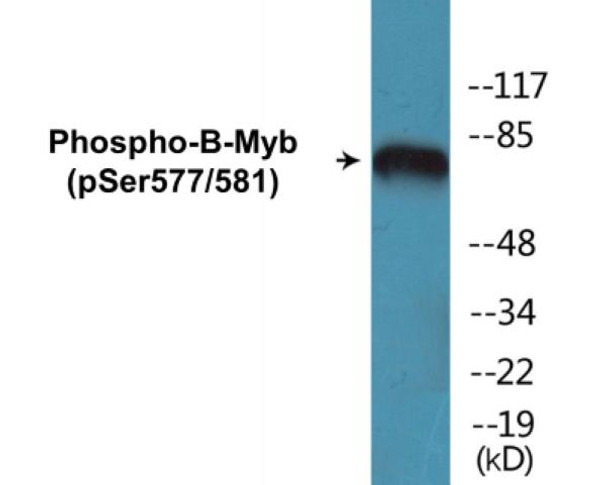 B-Myb (Phospho-Ser577/581)Colorimetric Cell-Based ELISA Kit (CBCAB01389)