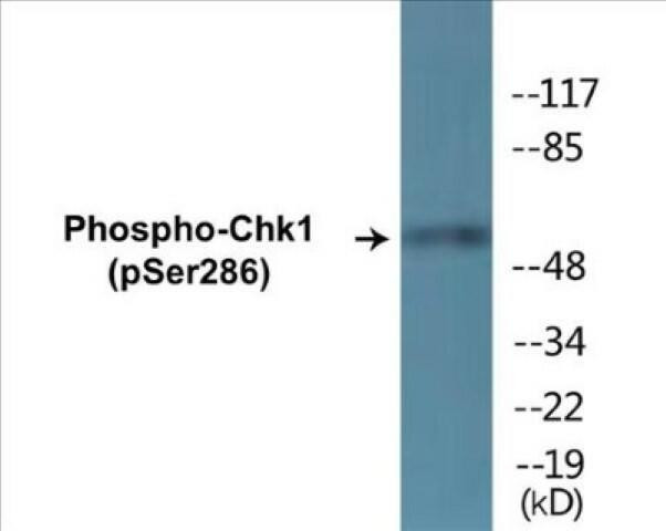 Chk1 (Phospho-Ser286)Colorimetric Cell-Based ELISA Kit (CBCAB01404)