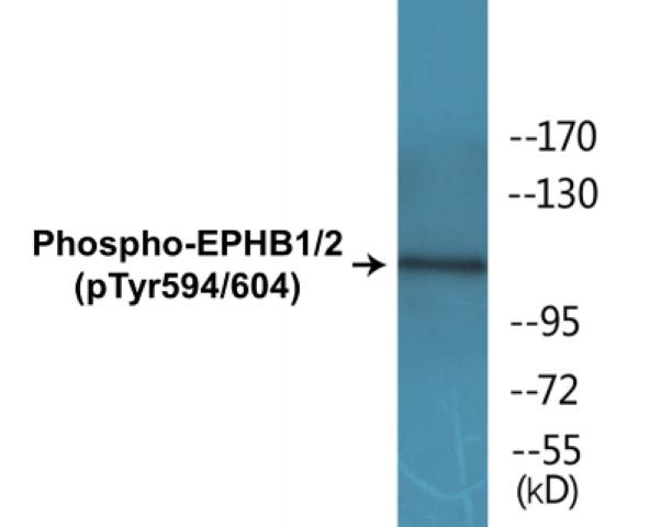 EPHB1/2 (Phospho-Tyr594/604)Colorimetric Cell-Based ELISA Kit (CBCAB01420)