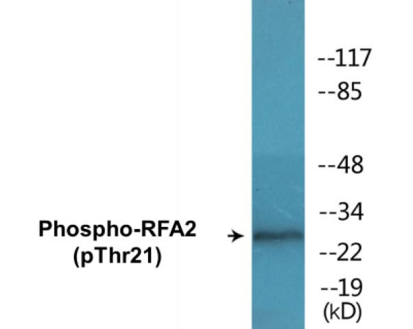 RFA2 (Phospho-Thr21)Colorimetric Cell-Based ELISA Kit (CBCAB01435)