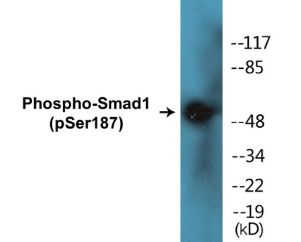 Smad1 (Phospho-Ser187)Colorimetric Cell-Based ELISA Kit (CBCAB01436)