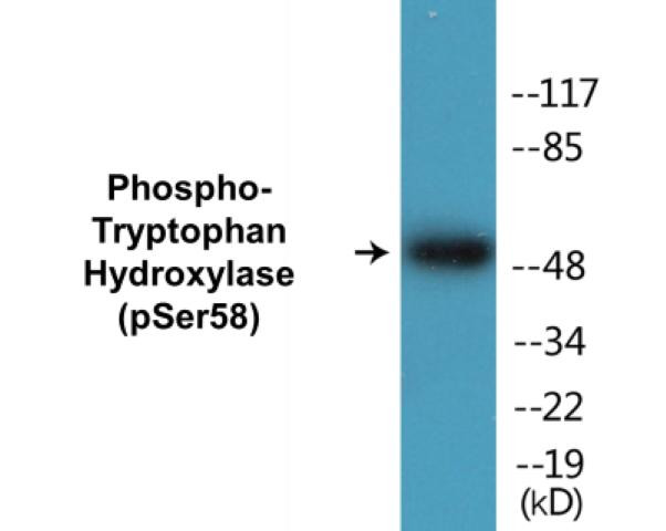 Tryptophan Hydroxylase (Phospho-Ser58)Colorimetric Cell-Based ELISA Kit (CBCAB01440)